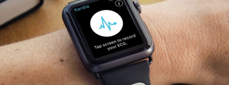Kardia Band Apple Watch.jpg